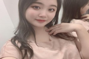 韓國Face-line整形醫(yī)院顴骨整形恢復果怎么樣附對比圖