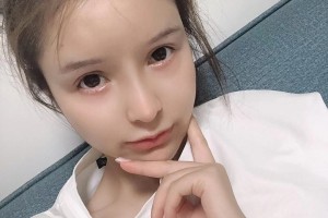 上海首爾麗格整形醫(yī)院下頜角手術(shù)讓顏值逆轉(zhuǎn)