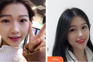 東莞特美口腔門診部歐陽(yáng)軍輝整形價(jià)格表附牙齒隱形矯正案例展示