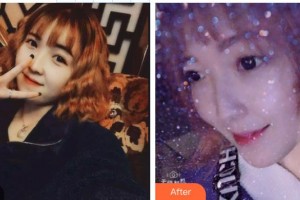 東莞維多利亞整形醫(yī)院李剛整形價(jià)格表附超聲波潔牙案例展示