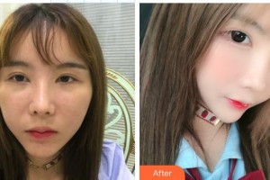 東莞南城固德口腔門診部孟建整形價格表附美白貼片案例展示