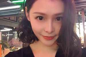 上海華美醫(yī)院下頜角手術(shù)怎么樣附手術(shù)過程分享