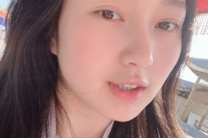 濟(jì)寧附屬醫(yī)院整形科下顎角感覺怎樣？真人案例圖片對比