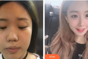 河源曙光醫(yī)療美容門診部何為整形價格表附牙齒隱形矯正案例展示