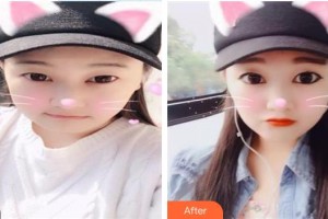 西南醫(yī)科大學附屬醫(yī)院整形燒傷外科耿康整形價格表附埋線提升案例展示