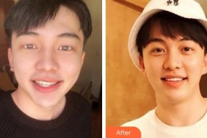 梅河口百顏醫(yī)療美容醫(yī)院李青松整形價(jià)格表附美白貼片案例展示