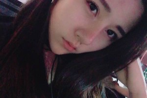 山東濟南章丘中醫(yī)院雙眼皮手術(shù)案例果圖