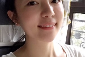 深圳臻瑞芝美醫(yī)院正規(guī)嗎牙齒矯正后變化太大了|價(jià)格表