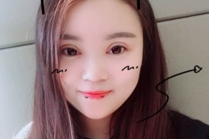 北京中日友好醫(yī)院怎么樣？附雙眼皮手術(shù)果圖