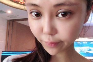 廈門(mén)第一醫(yī)院怎么樣附果圖