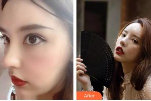 謝燕燕整形價(jià)格表附清潔祛痘案例展示