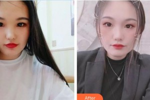 賀斌整形價(jià)格表附白瓷娃娃案例展示