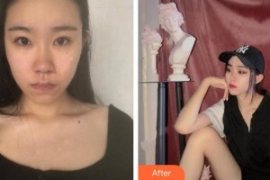 安岳潤白顏醫(yī)療整形美容門診部辛智希整形價(jià)格表附激光去紅血絲案例展示