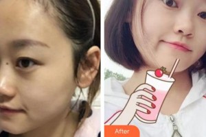 楚雄現(xiàn)代婦產(chǎn)醫(yī)院醫(yī)療美容科賈萬榮整形價(jià)格表附微針?biāo)獍咐故?>
</a>
<h3 class=