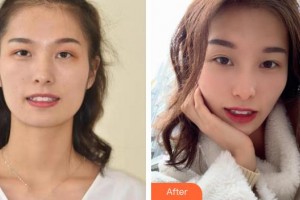 溧陽幫明口腔門診部金幫明整形價(jià)格表附牙齒隱形矯正案例展示