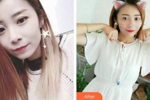 楚雄龐氏口腔門診部龐建國整形價(jià)格表附冷光美白案例展示