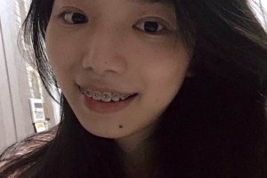 長春雅貝嘉口腔費(fèi)用高不高附價格表