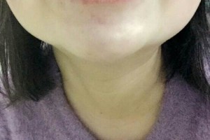 哈爾濱圣安口腔醫(yī)院怎么樣？附牙齒矯正果圖