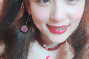 合肥艾雅醫(yī)療美容醫(yī)院怎么樣？附切開(kāi)雙眼皮對(duì)比圖