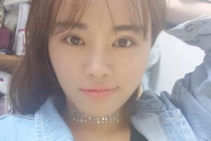 杭州117醫(yī)院整形科主任雙眼皮怎么樣？附果圖展示