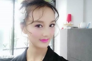 鄭州美立方整形醫(yī)院雙眼皮果好不好？怎么樣？附案例對比圖