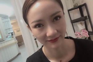 西安友誼醫(yī)院整形科怎么樣割雙眼皮日記分享|價格表