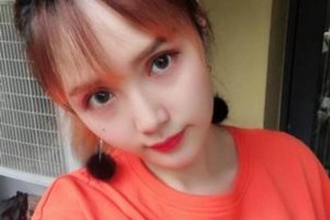 廈門(mén)大學(xué)附屬第一醫(yī)院整形科割雙眼皮醫(yī)生推薦