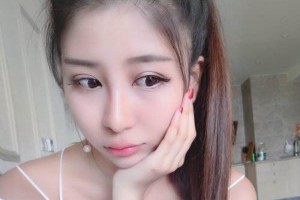 安徽省立醫(yī)院趙李平割雙眼皮怎么樣附果圖