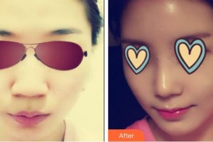 吳甲聲教授整形價格表附鼻部綜合案例展示