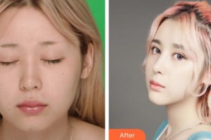 王敢整形價格表附鼻部綜合案例展示