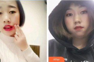 張少武整形價(jià)格表附根管調(diào)節(jié)案例展示