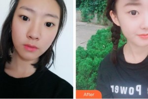 佘曉龍整形價(jià)格表附鼻部綜合案例展示