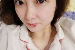 上海復(fù)美醫(yī)療美容門診部割雙眼皮日記|價(jià)格表