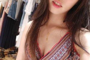 鄭州人民醫(yī)院整形科雙眼皮怎么樣？附手術(shù)果圖及收費(fèi)標(biāo)準(zhǔn)