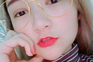 義烏張小紅美容醫(yī)院正規(guī)嗎雙眼皮價格表附案例