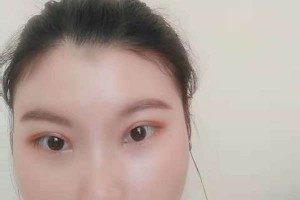 杭州浙二醫(yī)院整形醫(yī)院割雙眼皮果好不好|價格表