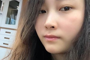 鄭大一附院激光美膚激光怎么樣怎么樣附果圖