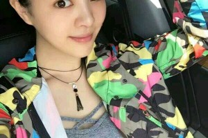 上海星璨整形醫(yī)院好不好隆鼻價格多少|(zhì)價格表