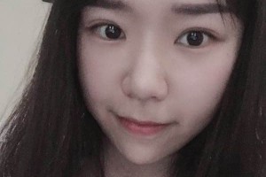 南京中大整形醫(yī)院光子嫩膚好不好？附果圖