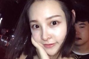 四川友誼醫(yī)院整形美容怎么樣附果圖