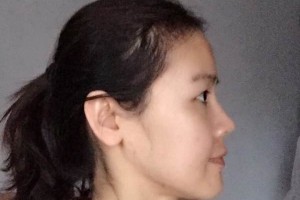 揚(yáng)州市人醫(yī)美容科怎么樣附果圖