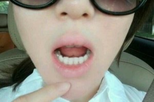 四川口腔醫(yī)院收費怎么樣附價格表