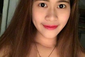 湖南株洲中心醫(yī)院整形科？雙眼皮術(shù)后注意事項！