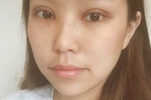 寧波第一院整容科項(xiàng)目好不好？科室醫(yī)生介紹！