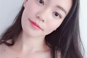 無錫中醫(yī)院整形科如何？雙眼皮成功案例測(cè)評(píng)分享！