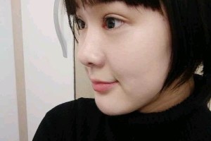 武漢天佑醫(yī)院整形雙眼皮行不行？真人圖片對比+醫(yī)生推薦