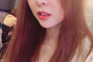 鄭州集美整形醫(yī)院隆鼻真人案例+醫(yī)生介紹！