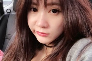 天津一中心整形外科隆鼻怎么樣？真人案例+醫(yī)生介紹