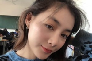 蘇州附二醫(yī)院整形科下頜角術(shù)后果？醫(yī)生推薦&費(fèi)用表