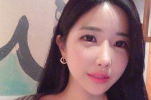 襄陽市中心醫(yī)院整形科下頜角術(shù)后果？較新價格表